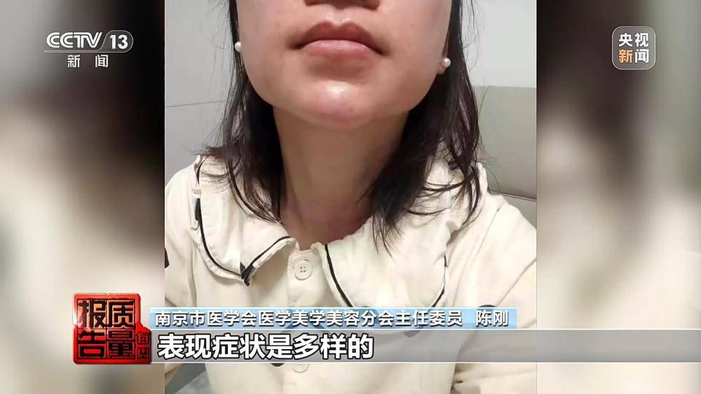 一針下去“美容”變“毀容” 記者調查醫美注射亂象