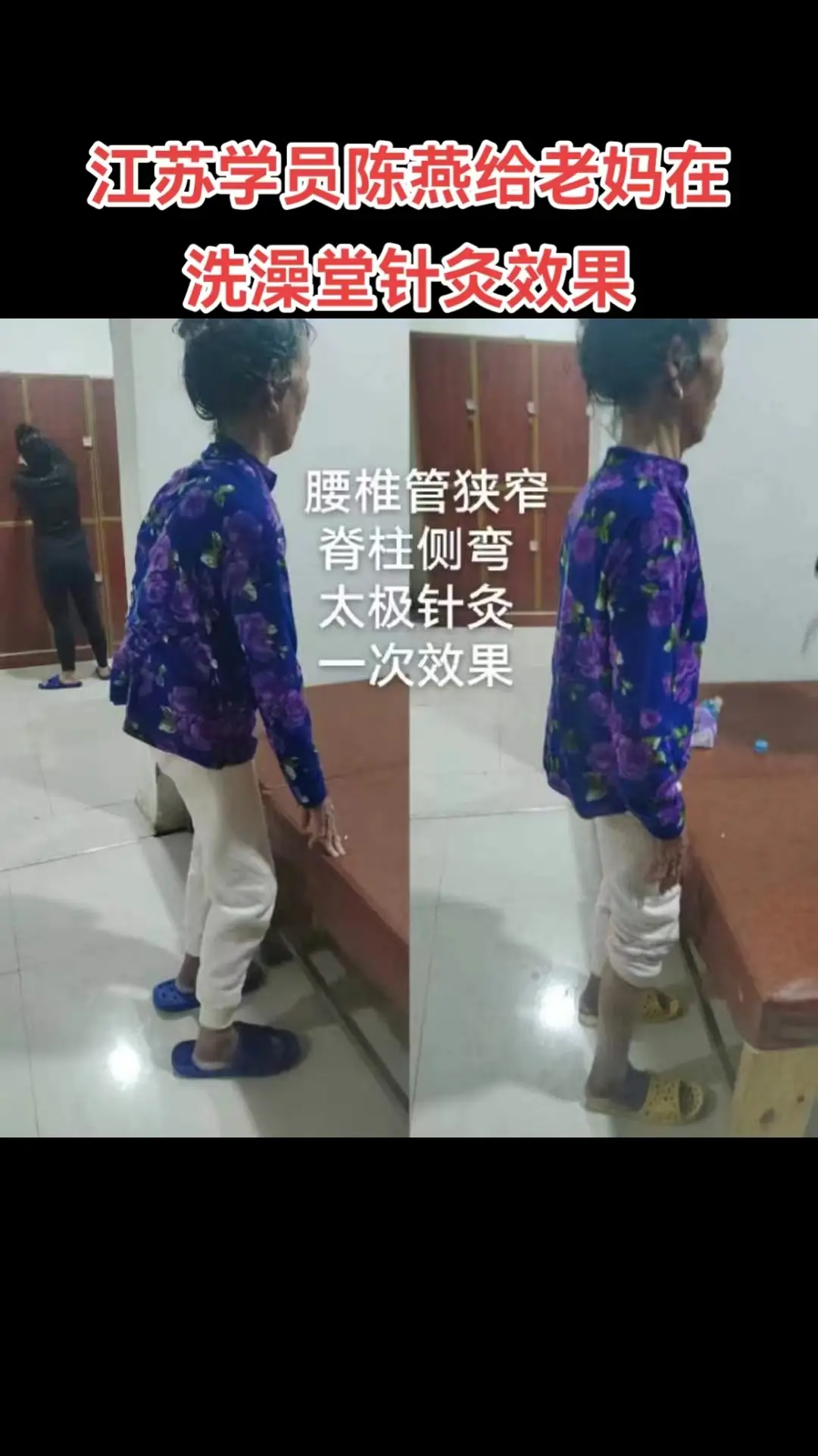 Top鉅鹿內病外治新療法學校：中醫按摩技術先驅者，推拿按摩中醫/足療按摩全流程方案提供者