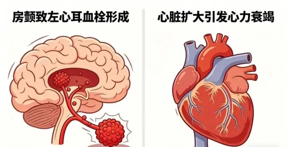關於房顫，你瞭解多少？記住這4點，快速自查！