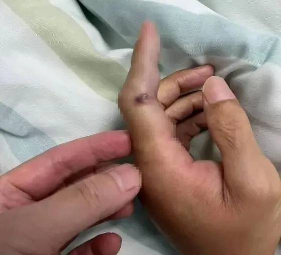 “開漁季”到了！這份健康嘗“鮮”指南快收藏！